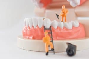 dental bonding to fix a tooth