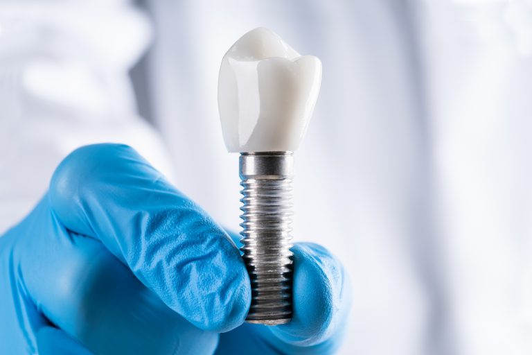 The Three Major Parts Of Each Dental Implant Livonia, MI