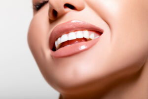 livonia teeth whitening