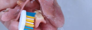 livonia partial denture