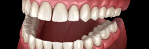 livonia tooth loss