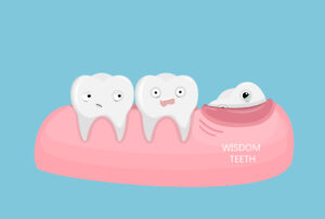 wisdom teeth livonia mi