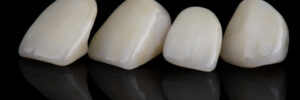 livonia dental crowns