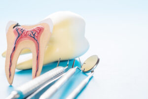 livonia root canal