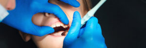 livonia dental fillings