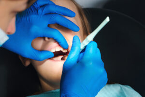 livonia dental fillings