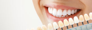 livonia teeth whitening