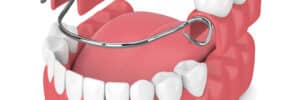 livonia partial denture