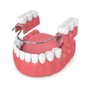 livonia partial denture